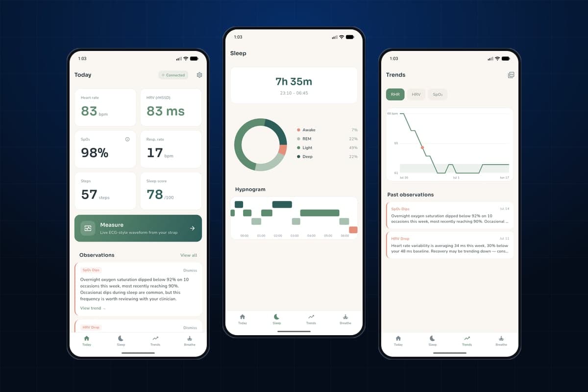 Pulse — Medical Wearable Companion — Cardiac wearable companion: live ECG-style vitals, night hypnogram, evidence-first trends
